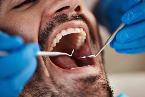 Best Urgent Tooth Repair  in Bellingham, WA